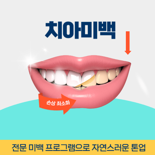 고양치과 고양시 치과 치아미백